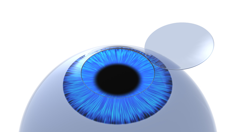 Corneal flap eye illustration